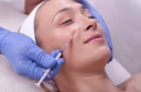 dermal fillers facial treatment