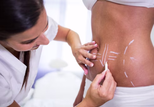 Skin Tightening After Weight Loss
